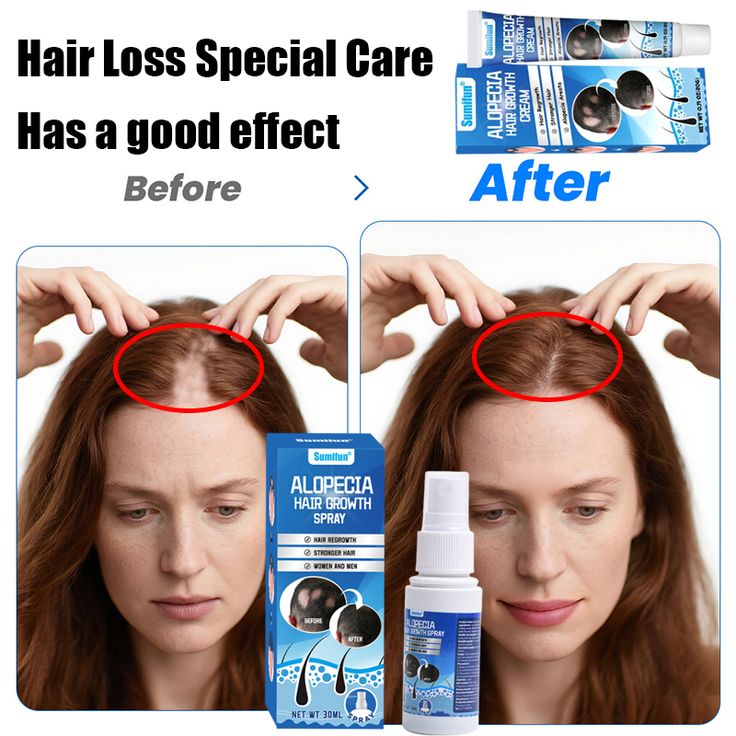 Sumifun Original Hair Regrowth Cream – Boost Hair Thickness & Growth